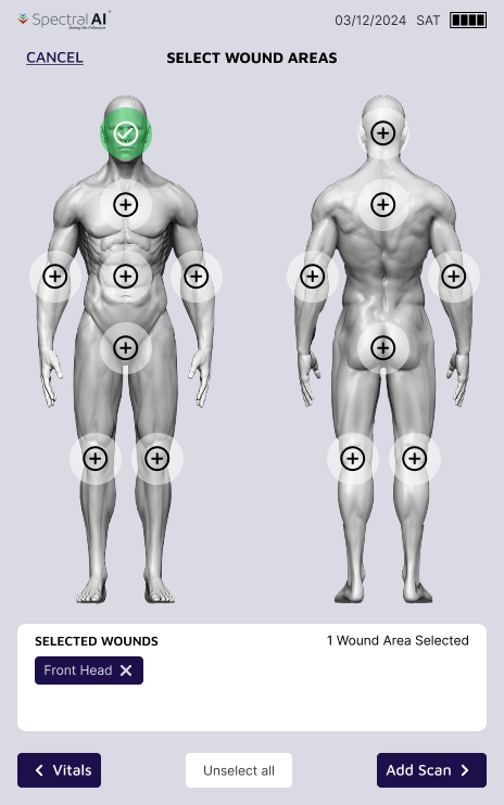 Simplified rule-of-nines body map with no suffix step — tap a region and move straight on