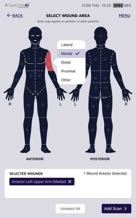 Body map with contextual suffix selection popping up next to the highlighted body region