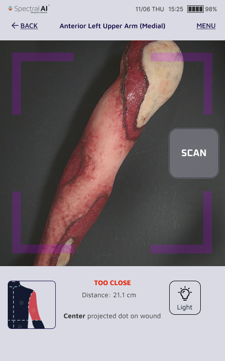Handheld capture screen with the frame turned magenta and a warning that the camera is too close to the wound
