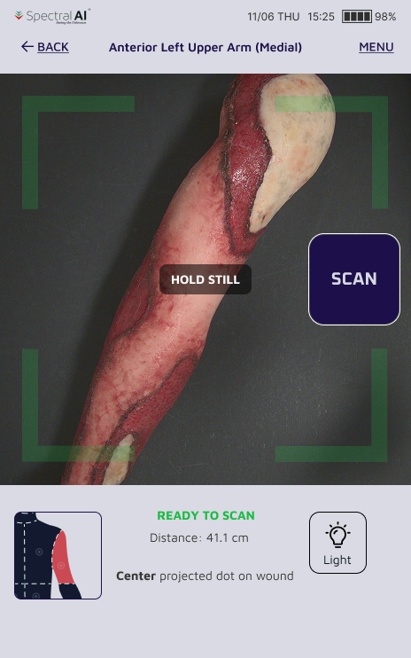 Handheld capture screen showing a 'hold still' warning triggered by the motion sensor