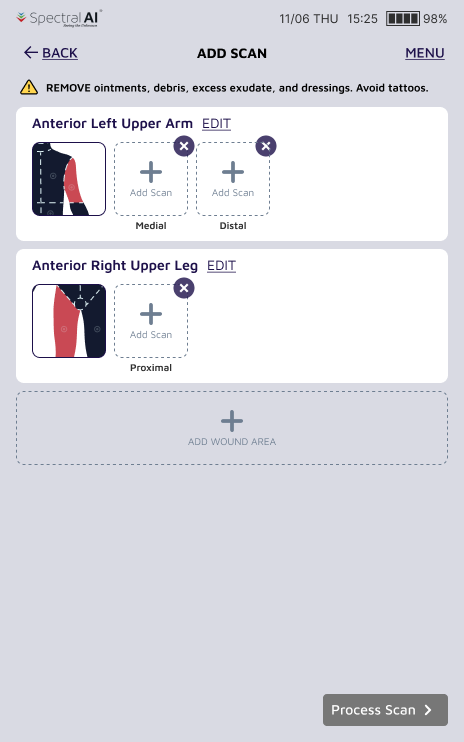 Wound overview screen with add/delete controls available directly, before capture continues